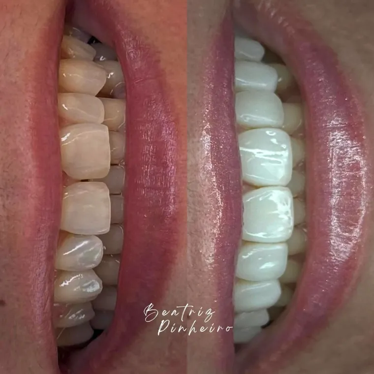 Detalhe aproximado do acabamento e do brilho das facetas