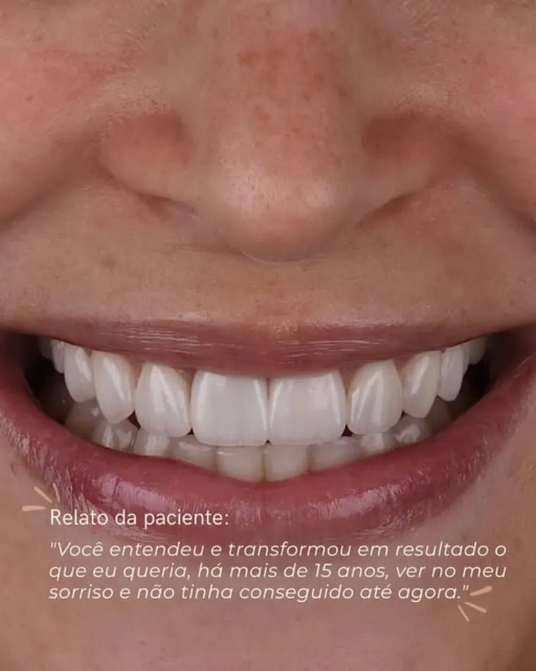 Sorriso finalizado, acompanhado do relato da paciente